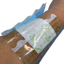 Post-Op dressing Post-Op dressing